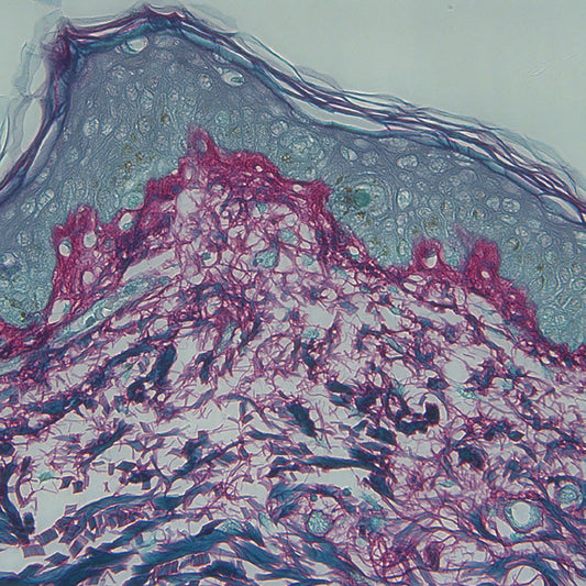 Collagen is a protein that provides the skin with its tone